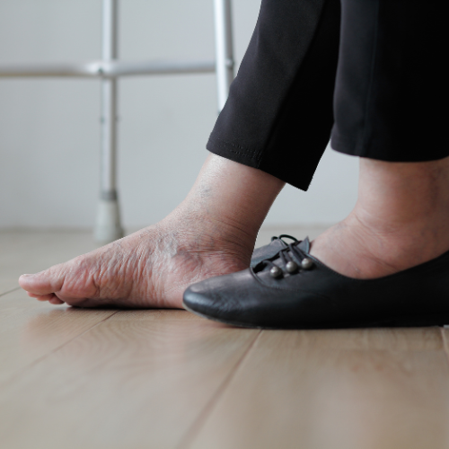 【久留米市の糖尿病内科・循環器内科】顔や手足がむくむ原因とは？心臓のSOSサインを見逃さないために専門医が解説！