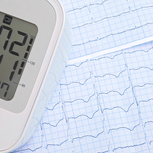 【久留米市の糖尿病内科・循環器内科】健診の心電図異常を放置しないで！